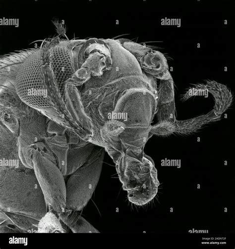 Drosphila Mutant With Leg Antennae Scanning Electron Micrograph Sem