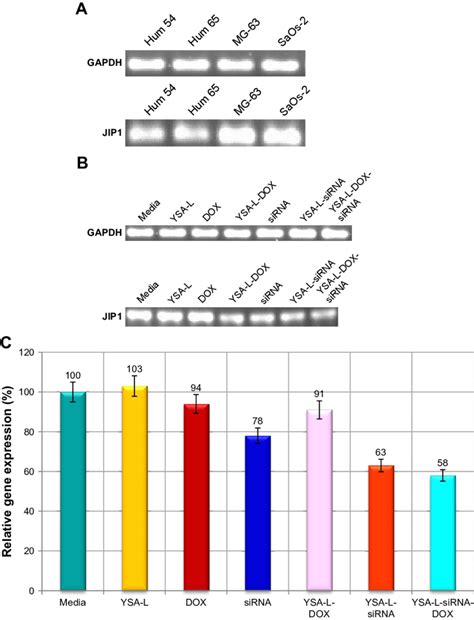 Gel Retardation Assay To Evaluate The Gene Expression In Four Different