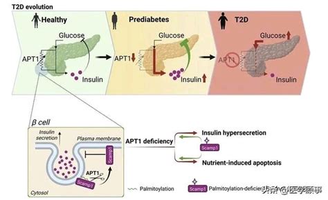 《细胞》子刊：破解肥胖导致糖尿病的关键环节！