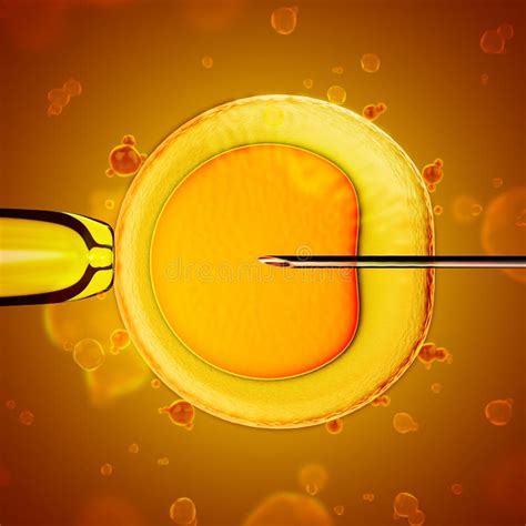 Inseminação Artificial Fertilização De óvulos Humanos Por Esperma FIV