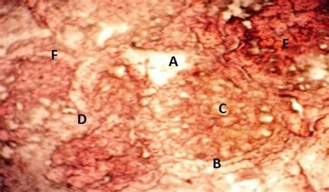 C Microscopic Examination Showed The Effect Of 025 Mgl Concentration Download Scientific