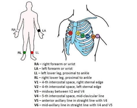 Interpreting ECG - Echocardiography Principles - Student Nurse Life