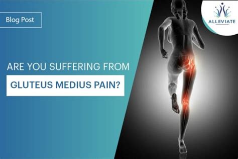 Gluteus Medius Pain Types Causes Symptoms Diagnosis Treatment