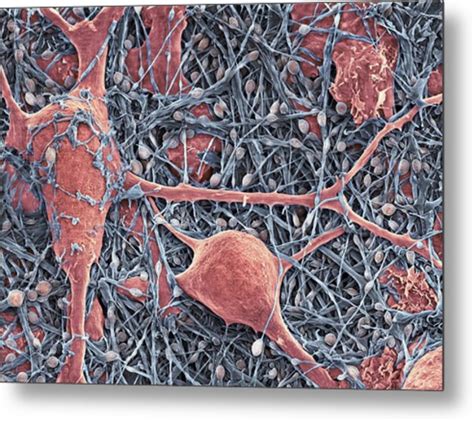 Nerve Cells And Glial Cells Sem Photograph By Thomas Deerinck Ncmir