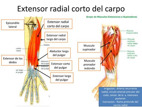 Extensor Ulnar Do Carpo BRAINCP