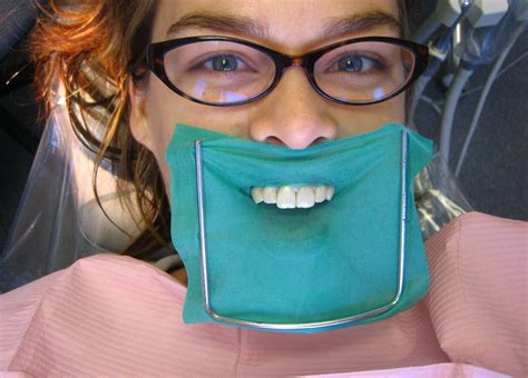 Dental Dam Diagram