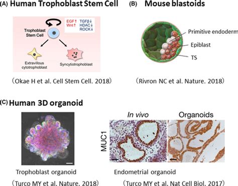 Unique Features And Emerging In Vitro Models Of Human Placental