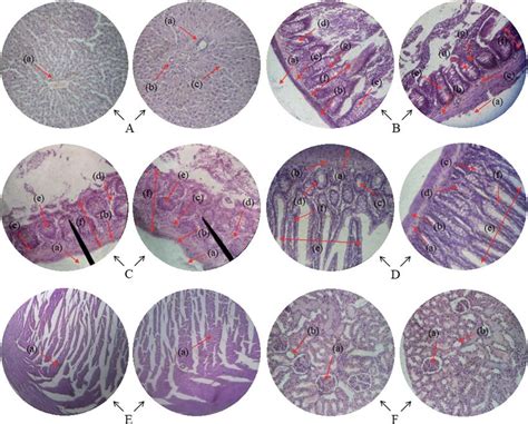 Histopathology Of Liver A Central Vein A Porta Hepatis B And