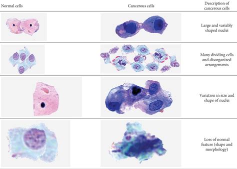 Cancer Cells Vs Normal Cells Chart