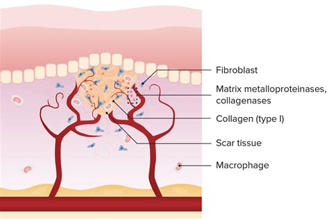 Wound Healing Process Diagram Wound Granulation Remodeling L