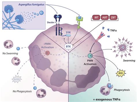 Jci Insight Btk Inhibitorinduced Defects In Human Neutrophil