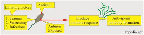 Semen Part 4 Work Up For Fertility Work Up Of Infertile Couple