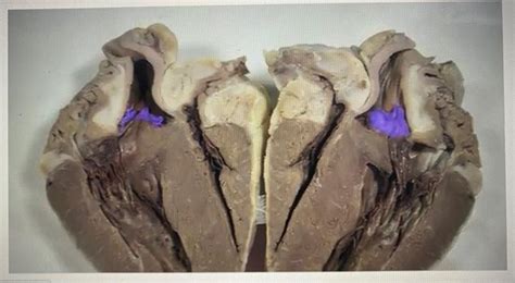 Solved Identify The Highlighted Structure In The Picture Chegg