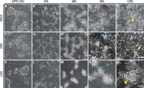 Frontiers Induction Of Neural Crest Stem Cells From Bardet Biedl Syndrome Patient Derived Hipscs