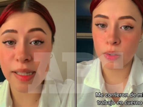 Joven Denuncia En Tiktok Que Fue Despedida De Restaurante Por Pintarse