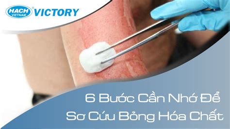 Xử Lý Bỏng Hóa Chất 6 Bước Sơ Cứu An Toàn Hóa Chất Hach