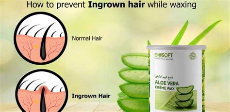 Bikini Line Ingrown Hair