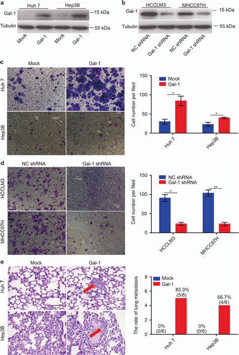 High Expression Of Gal 1 Promotes Hcc Metastasis Both In Vitro And In