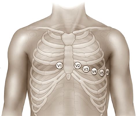 Ce trebuie să știi despre EKG Ghid pentru pacienți eHealth Romania