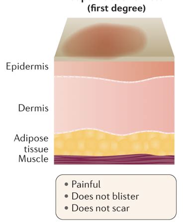 Ortho Final Exam Flashcards Quizlet