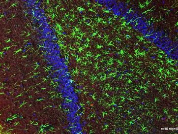 Linea De Investigacion De Bases Moleculares De La Neurodegeneraci N Y