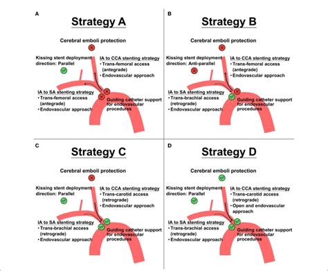 Figure E Four Proposed Treatment Strategies A D For Kissing Stent