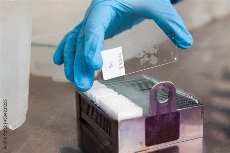 Scientist Placing Slides With Paraffin Embedded Tissue Samples Into A