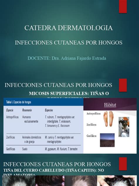 Clase 7 Infecciones Cutaneas Por Hongos Pdf