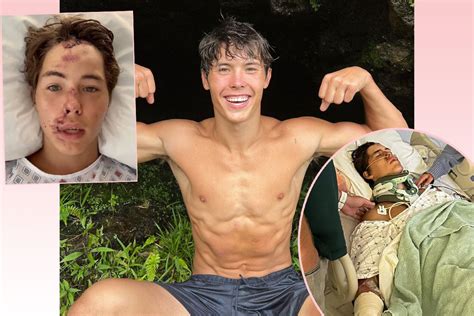 TikTok Star Caleb Coffee In ICU After Falling From 60 To 80 Foot