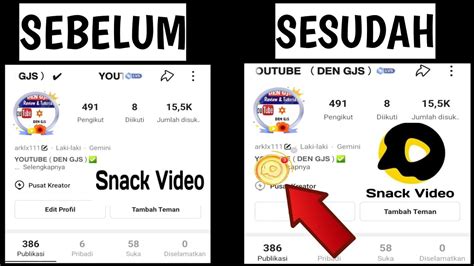 Cara Mengatasi Snack Video Tidak Muncul Gambar Koin YouTube