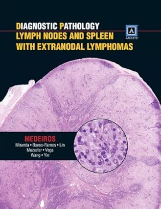 Diagnostic Pathology Lymph Nodes And Spleen With Extranodal Lymphomas