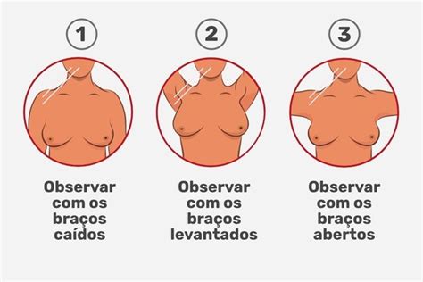 Como Fazer O Autoexame De Mama E Sinais De Alerta Tua Sa De