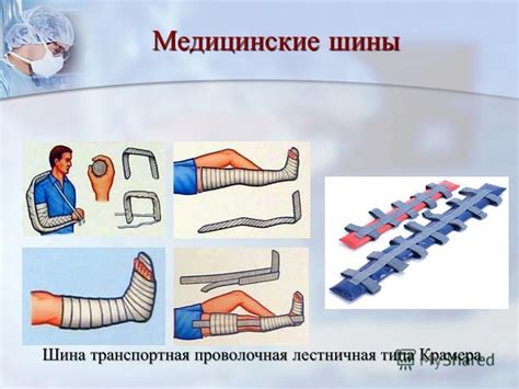 Презентация на тему: "Транспортная иммобилизация". Скачать бесплатно и ...
