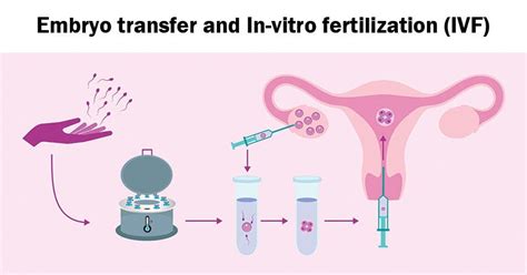 Artificial Intelligence In High Quality Embryo Selection For Ivf Vsinghbisen