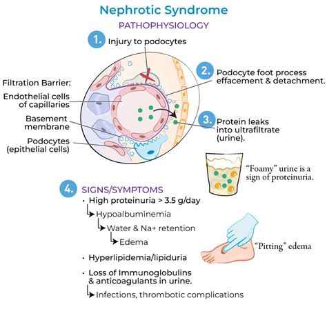 Clinical Pathology Glossary Nephrotic Syndrome Key Pathologies