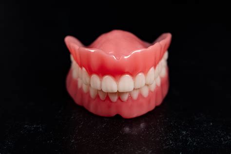 3D Printed Dentures | Express Dental Laboratory