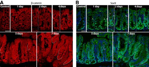 Conditional Inactivation Of Apc In Mouse Colon Is Linked To Induction