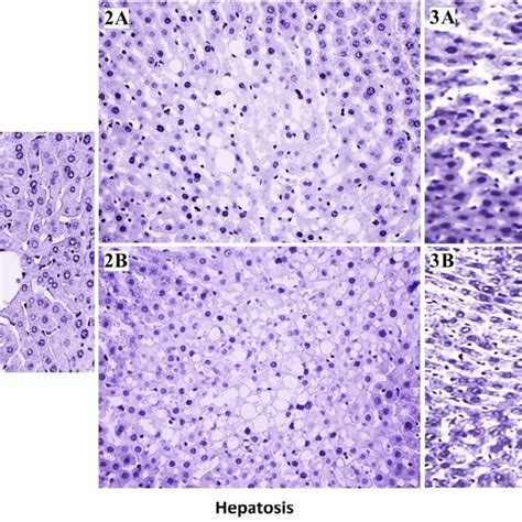 Typical Histological Analysis Of Liver Of Rats With Drug‐induced Download Scientific Diagram