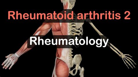 Rheumatoid Arthritis Extra Articular Manifestations Youtube