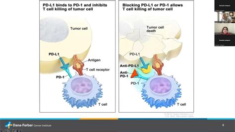 Digesting The Science An Informational Series On Esophageal And Gastric Cancer Immunotherapy