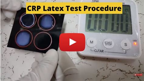 C Reactive Protein Test Crp Latex Test Procedure Youtube