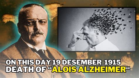 On This Day “december 19 1915” Death Of Alois Alzheimer The Discoverer