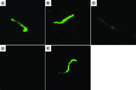 Membrane Location Of The Cardiolipin Antigen In Treponema Pallidum