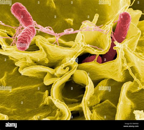 Salmonella Bacteria A Common Cause Of Food Poisoning Invade An Immune