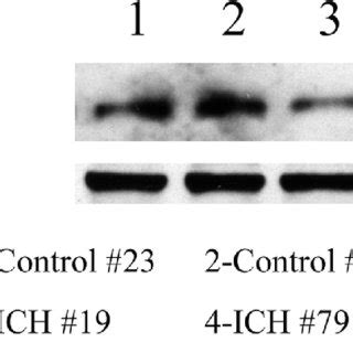 The Protein Level Of Pink Is Decreased In Ich Patients Western Blot