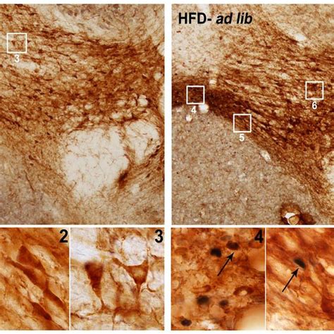 Acute Hfd Activates C Fos In Orexin Ir Neurons Of The Lha Panels Show