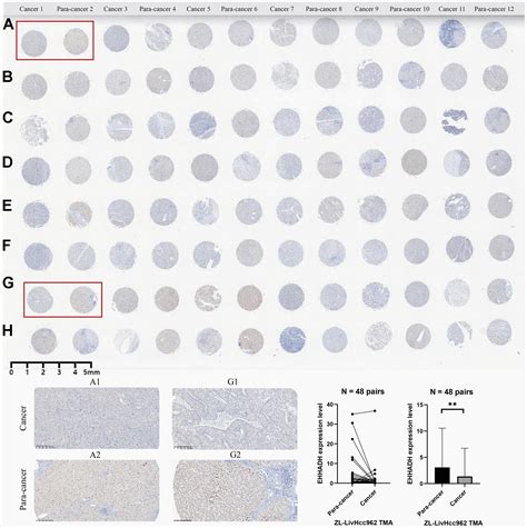 Comprehensive Characterization Of β Alanine Metabolism Related Genes In