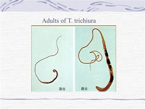 Trichuris Trichiura Worm