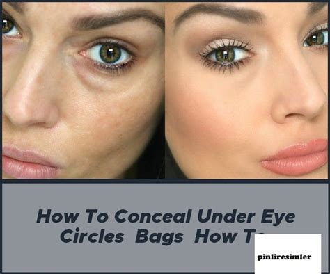 How To Conceal Under Eye Circles Bags How To In 2020 Undereye Circles