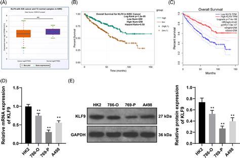 Klf Is Downregulated In Rcc A B The Expression Pattern Of Klf In